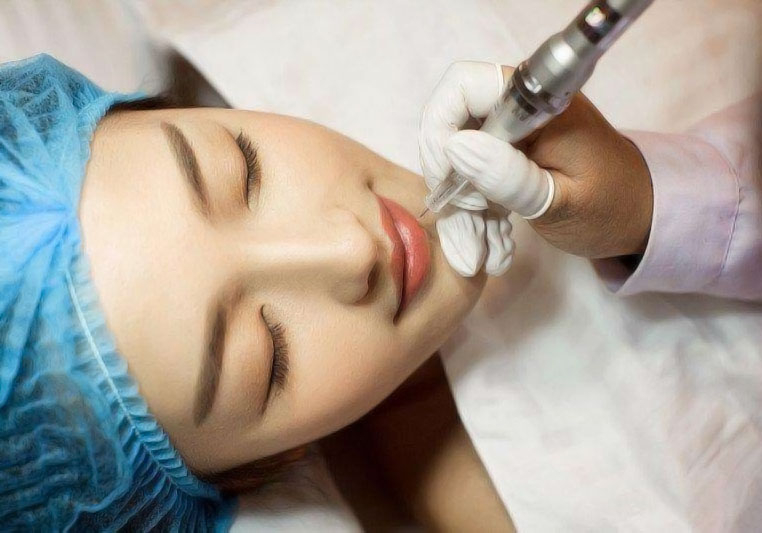 現(xiàn)在流行的三種紋唇類型有哪些